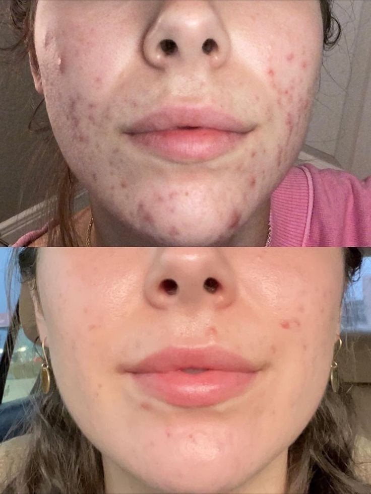 Customer result